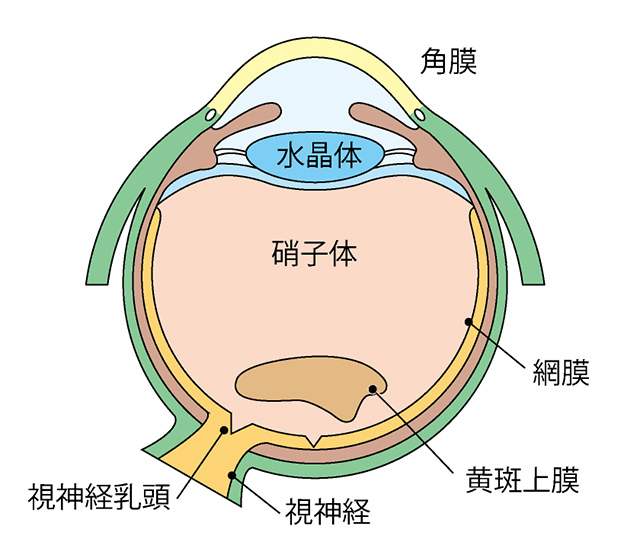 黄斑前膜